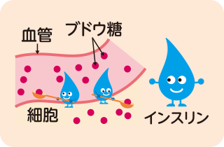 糖尿病の原因と判断基準