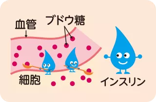 糖尿病の原因と判断基準