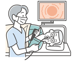 経口内視鏡の特徴