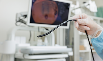 当院での観点：細径スコープ運用では“画質差のメリット”がなくなる